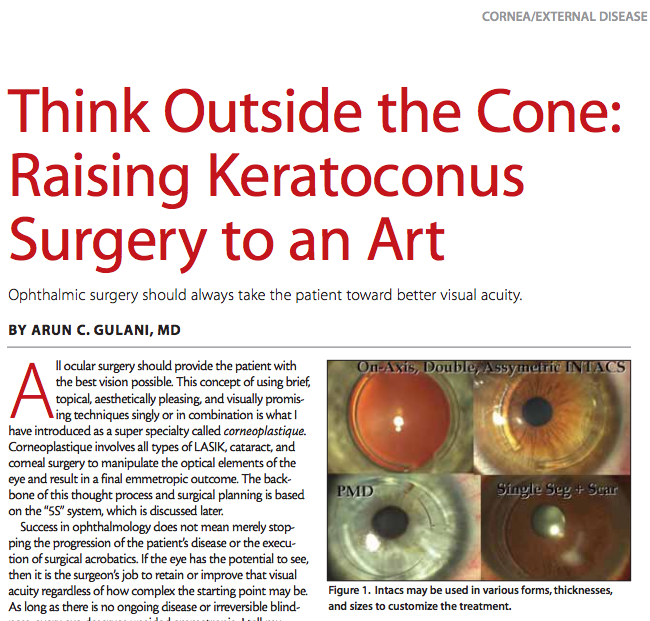 Keratoconus INTACS Cross Linking Jacksonville FL Florida