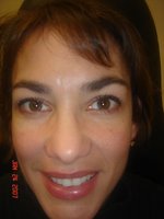 Geraldine Janzen Pinguecula followed by Laser Surgery Gulani Vision Institute Jacksonville Florida