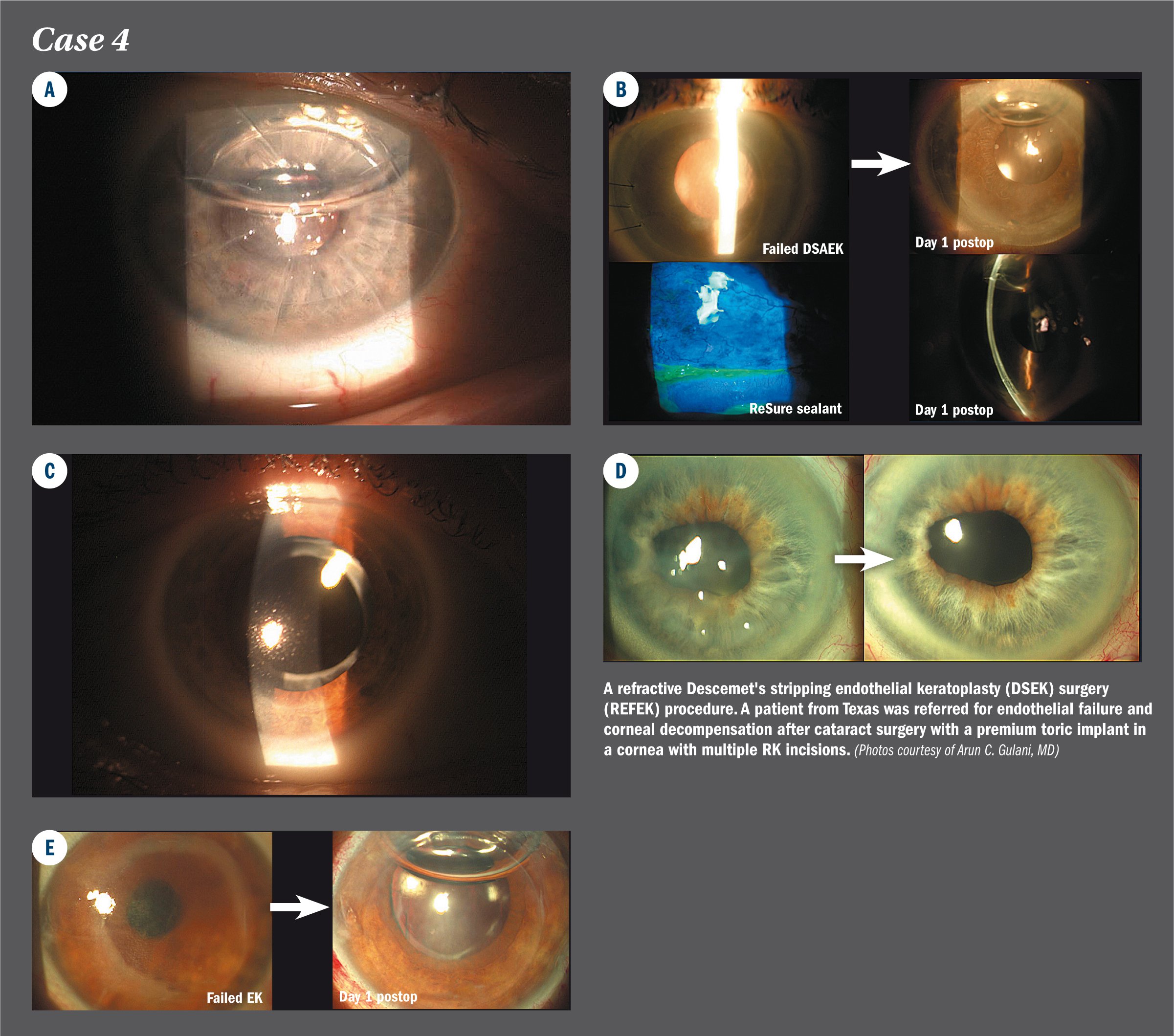 Vision Correction Surgery Jacksonville Vision Surgery Florida