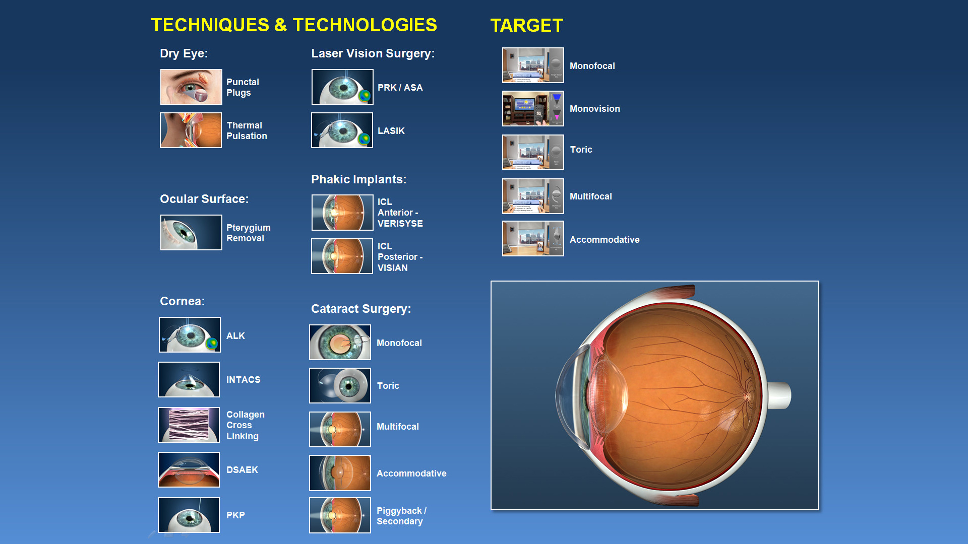 lasik ophthalmic surgeons wherein gulanivision