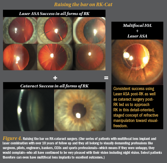 close up photo of an eye with blinding radial keratotomy scars