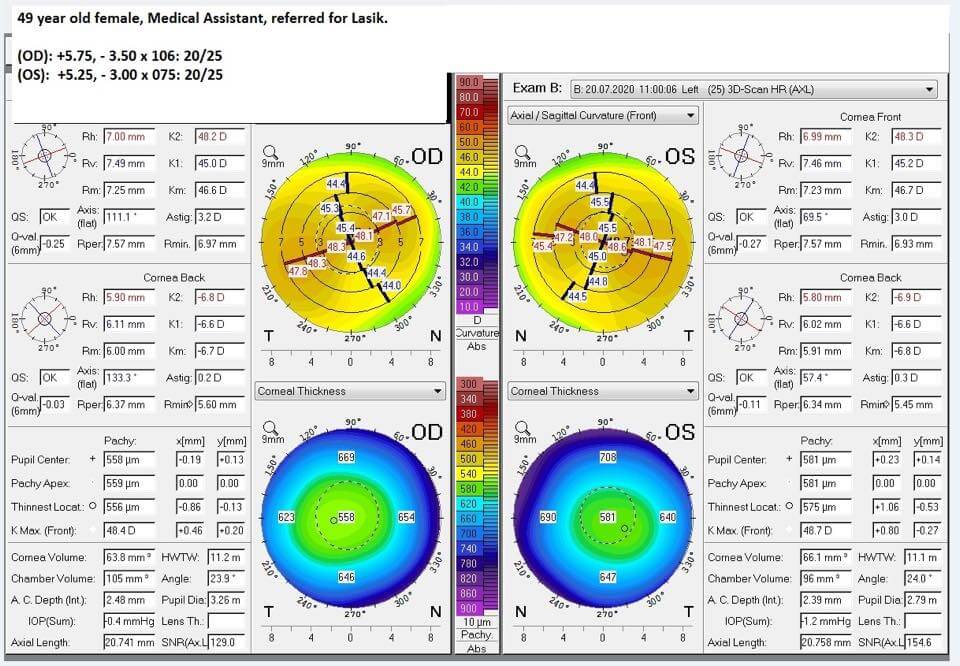 For Eye Doctors only, Releasing Our GPS Series