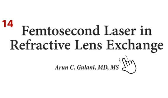 Femtosecond Laser in Refractive Lens Exchange