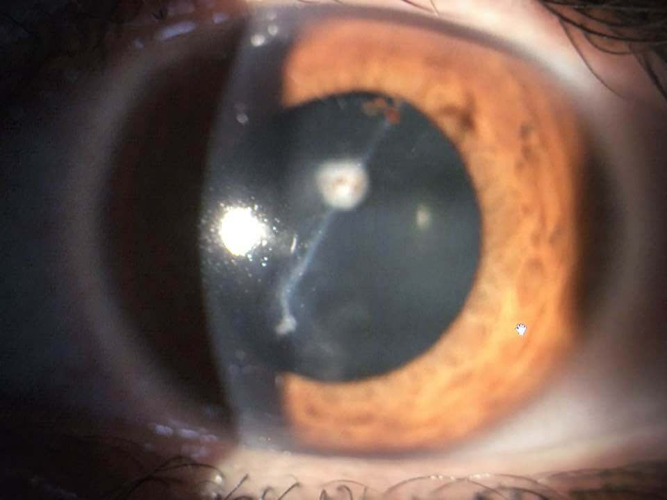 Eye Scan
