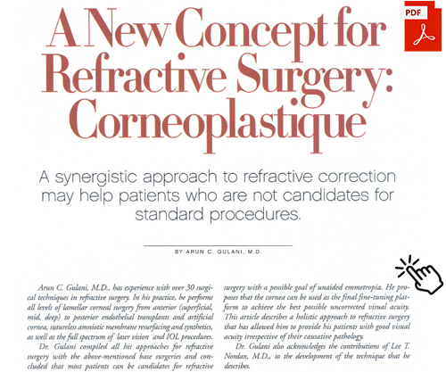 A New Concept for Refractive Surgery: Corneoplastique - A synergistic approach to refractive correction