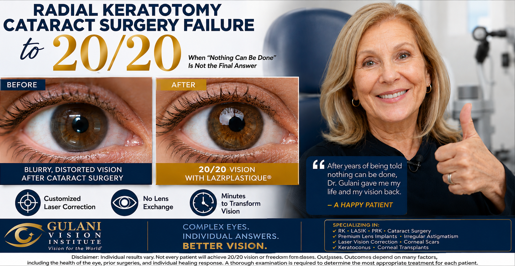 Radial Keratotomy RK patient with failed cataract surgery and blurry vision achieved 20/20 vision following customized LaZrPlastique® laser correction at Gulani Vision Institute.