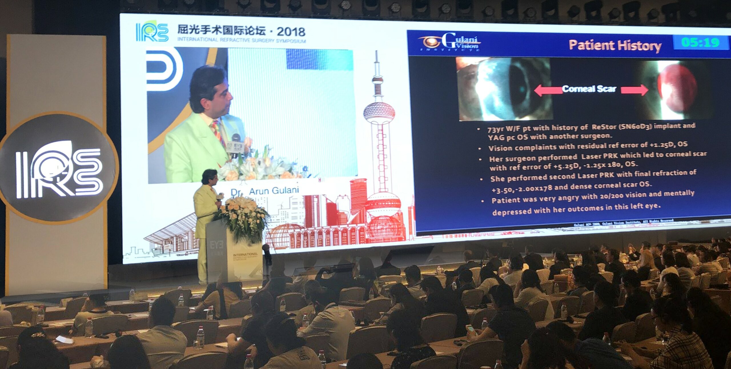 Keratoconus expert Dr. Arun Gulani teaching eye surgeons internationally on complex corneal and refractive surgery, advanced keratoconus and vision rehabilitation.