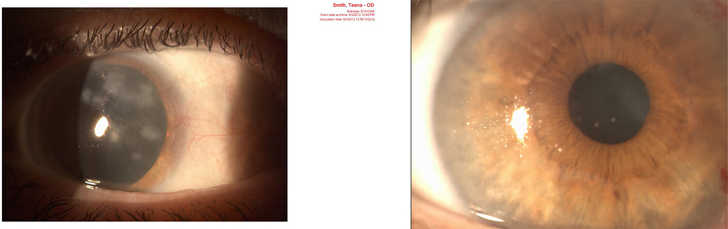 Scan of Eyes