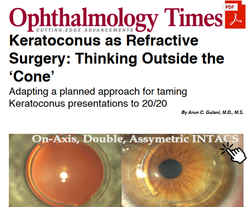 Keratoconus as Refractive Surgery