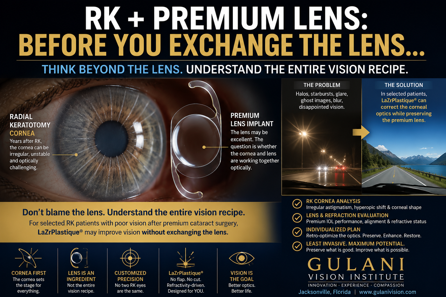 Radial Keratotomy patient with premium cataract lens problems evaluated for LaZrPlastique correction without IOL exchange