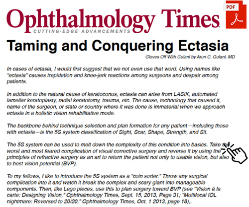 Taming and Conquering Ectasia