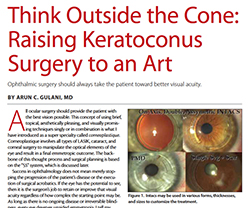 Thinking Outside the Cone