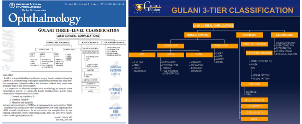 Gulani 3-tier classification for common lasik complications