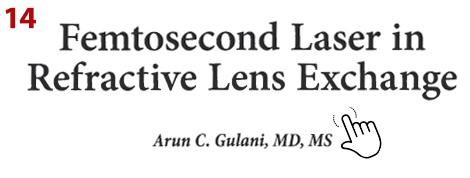 Femtosecond Laser in Refractive Lens Exchange